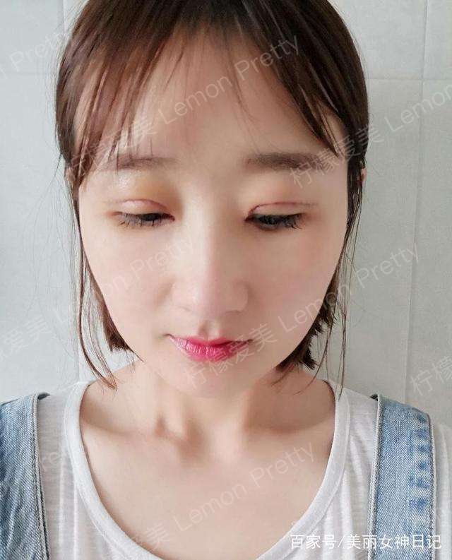 小保姆全切双眼皮 开眼角1个月后问:大家看下是不是"大小眼"?