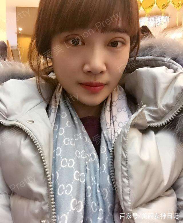 内双的小姐姐做双眼皮后,闺蜜说她画个眼妆,立刻升级当女神了!