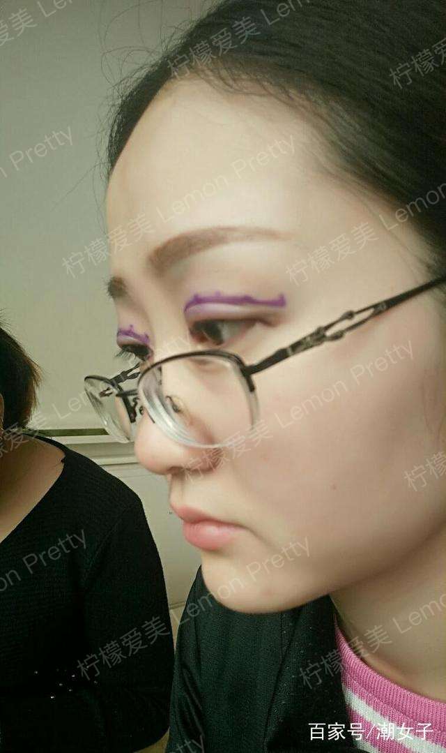 女实习生做过"双眼皮埋线 纹眉"后说:同事说我突然间成熟了!