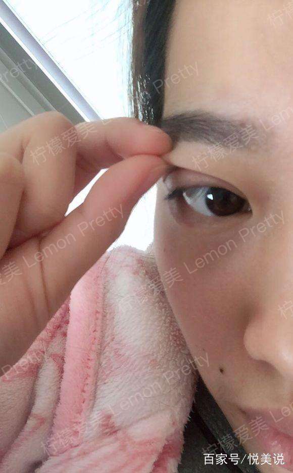 自从女职员做过"全切双眼皮7mm"后,同事们说她变老了