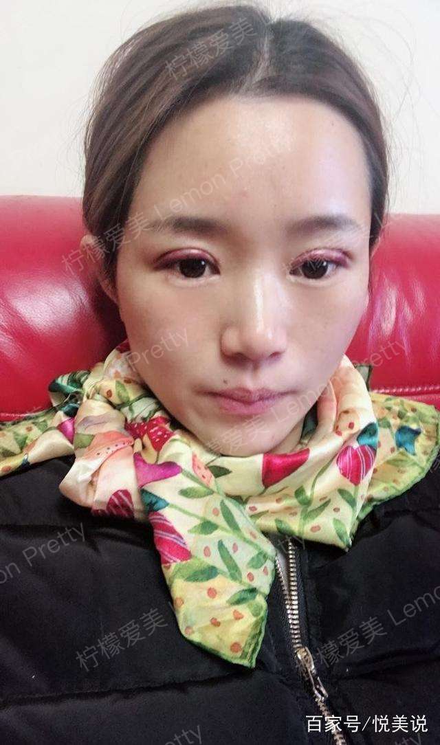 本妹子,26岁,目前在一家公司的市场部上班,做销售,天生一副单眼皮,忍