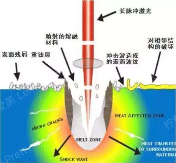 纳秒激光,皮秒激光,飞秒激光,你分得清吗?