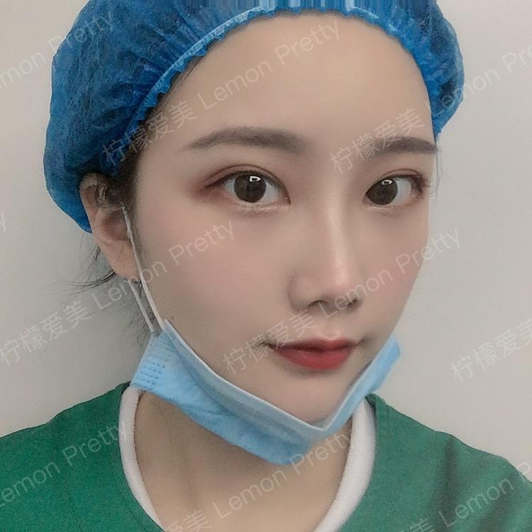 双眼皮是全切还是埋线好