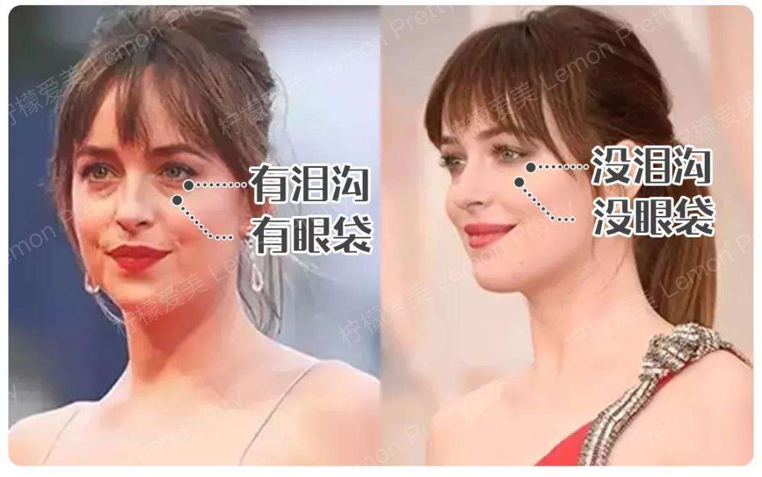 女星离开美颜滤镜后,眼袋 泪沟竟让她颜值崩塌?
