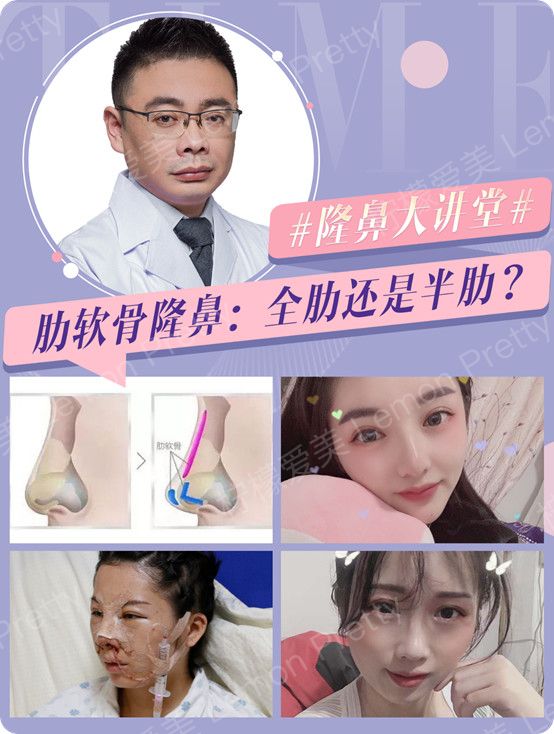 硅胶假体隆鼻的优缺点?