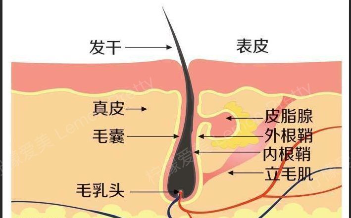 毛囊堵塞会导致脱发?