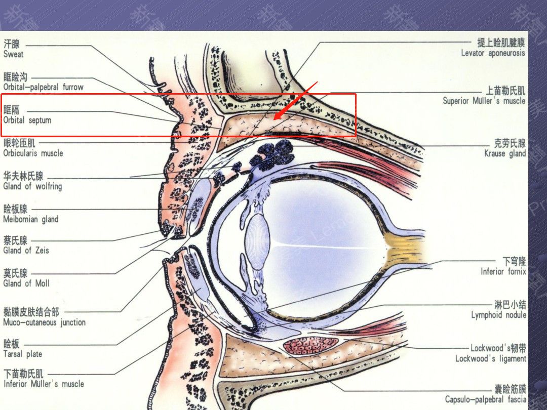 而眶隔就是将眼眶前后分隔开的一层膜样的物质,它从眼眶周围延伸到
