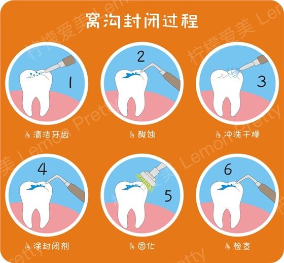 六龄牙终生不换,粑粑麻麻知道吗?