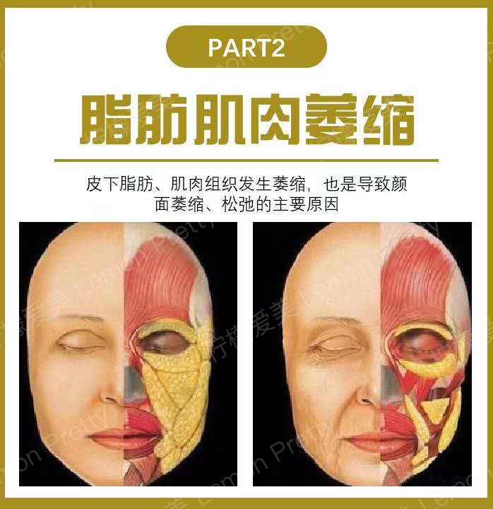 面部抗衰小课堂—你的脸为什么会慢慢老去?