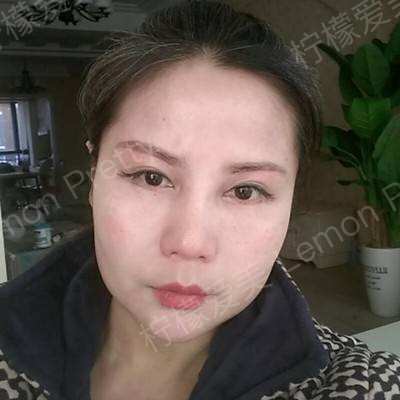 提眉术〕提眉半个月啦.