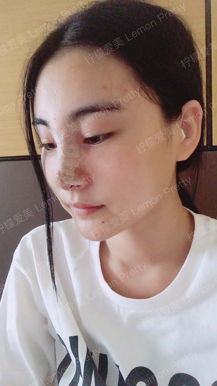 涂一乐鼻综合的美丽日记-柠檬爱美app