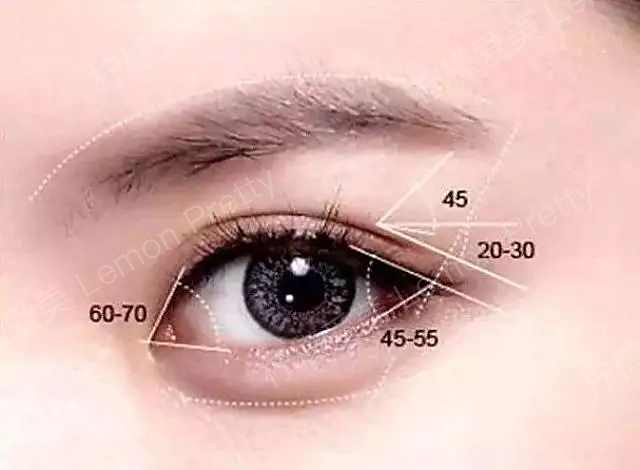 科普篇 || 内眼角开得过大可以修复吗