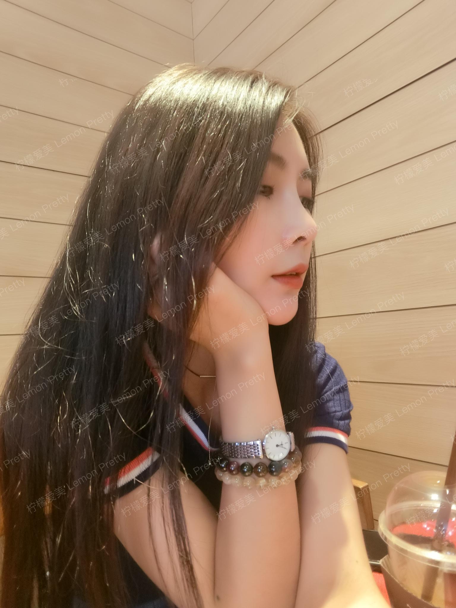 淳于雅晴鼻综合的美丽日记-柠檬爱美app