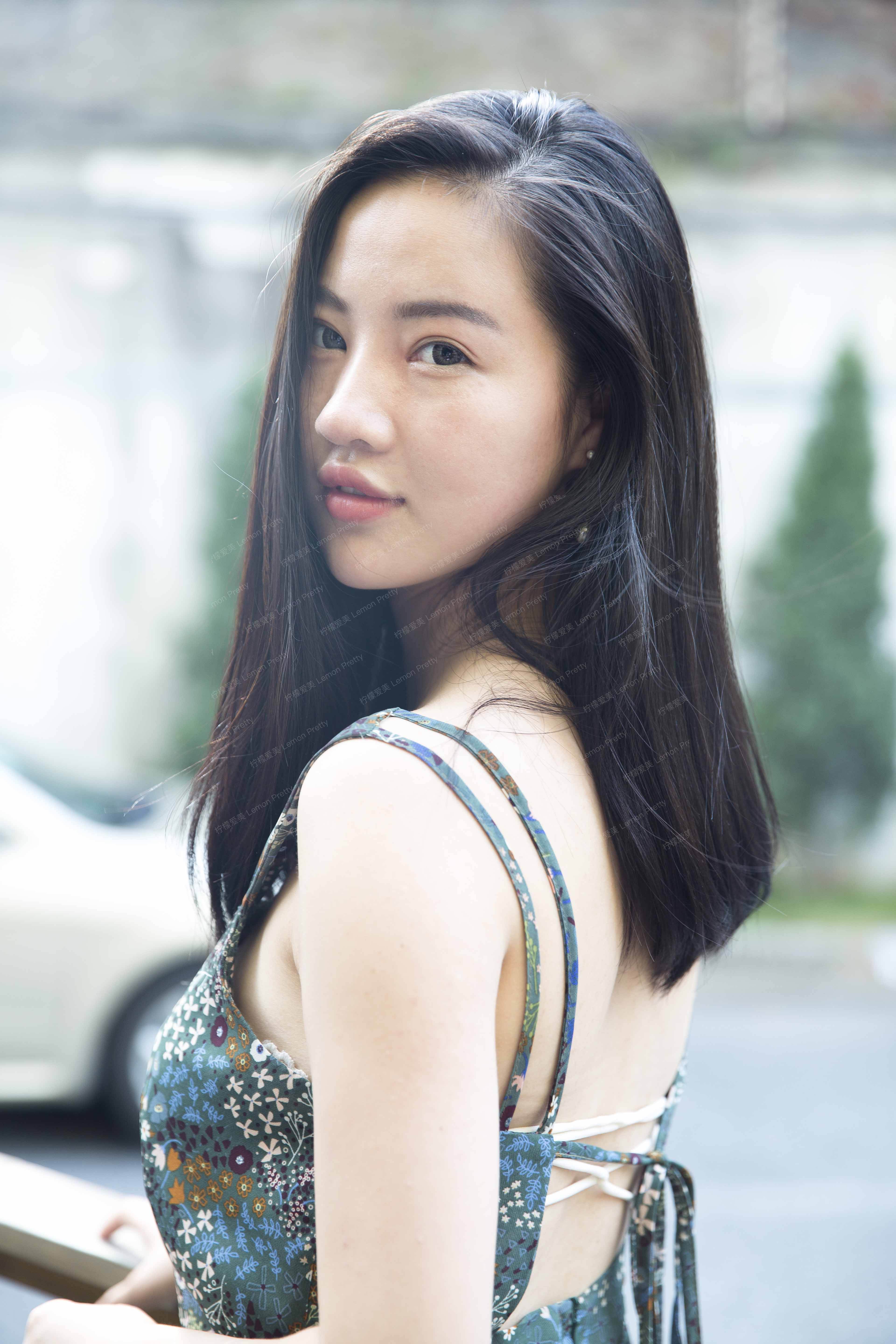 檬檬7485肉毒素瘦脸的美丽日记-柠檬爱美app