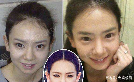 戚薇饰演的陈可在小城市的时候 双马尾素面朝天 但是大双眼皮十分瞩目