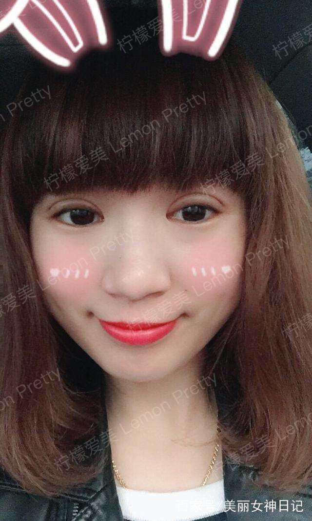 萌妹子做"埋线双眼皮"1个月后,室友夸我眼睛变大,有神了!
