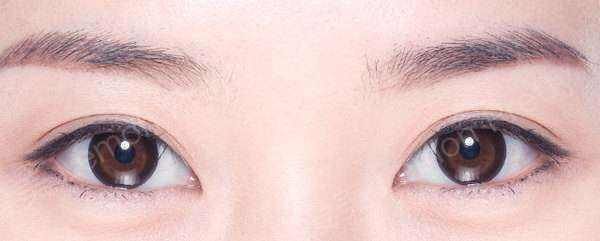 开扇双眼皮,最经典的双眼皮,内窄外宽,有点类似"桃花眼",眼角微微上抬