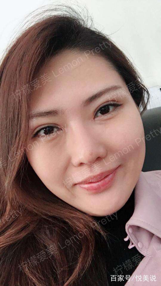 宝妈做过"全切双眼皮 开眼角"后说:哎,只能活在美颜中了