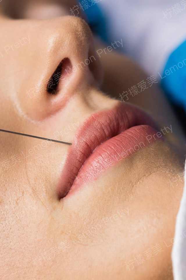 选择激光脱唇毛 会给皮肤造成伤害吗