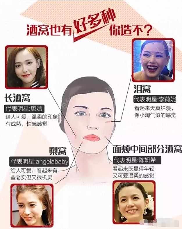 85%的姑娘都想要酒窝,戳进来了解酒窝成形术,你是属于哪种酒窝