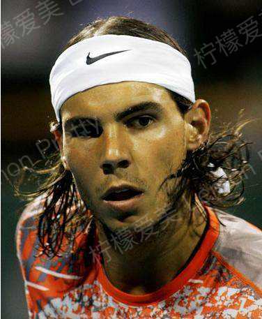 网球大神纳达尔植发这事,你怎么看?