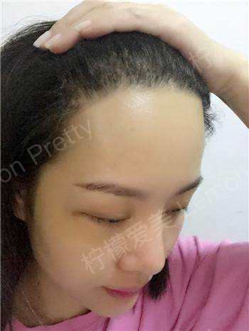 现在长长了,看起来顺眼多了,光洁的大额头终于远离我了,居然看起来很