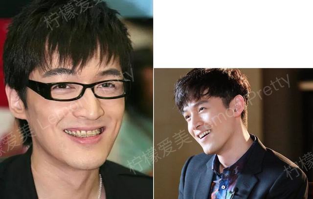 龅牙妹肥胖妞外翻香肠嘴 baby颖儿郑爽一开始也并没有美美美