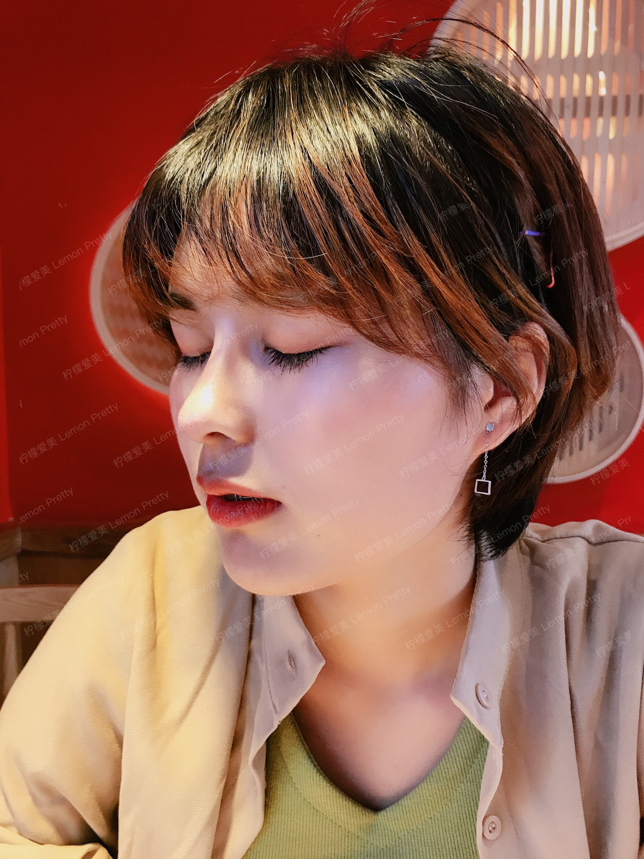 术后第51天变美日记_柠檬爱美_鼻综合,自体软骨垫鼻基底