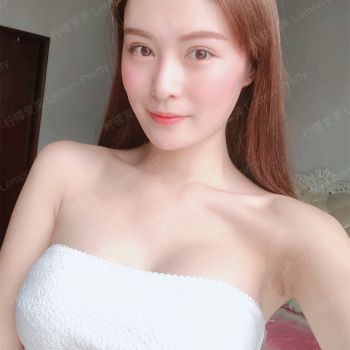 【假体隆胸】【进口】曼托半球型 真实/自然聚拢伤乳不腺 宛如天生