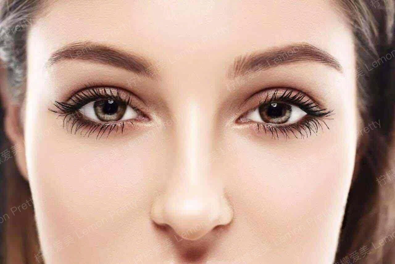 亚洲人适合做深邃的欧式双眼皮吗