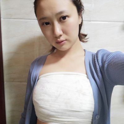 自体脂肪隆胸