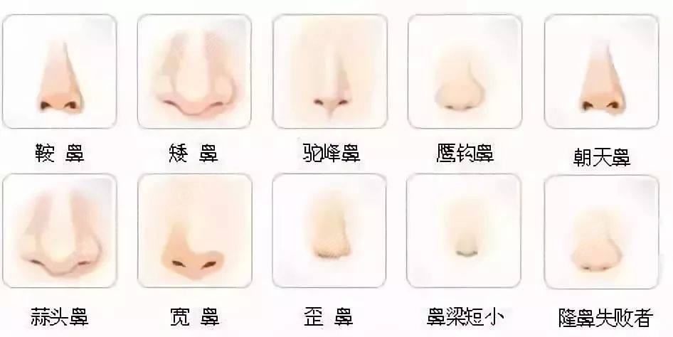 1,鼻梁塌陷,鼻头扁平的人: 整个鼻子都很塌,完全没立体感,鼻子没有
