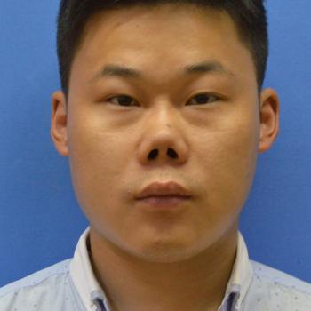 朝天鼻矫正步骤