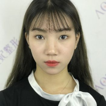 变美日记_真实体验经历_柠檬爱美_隐耳矫正