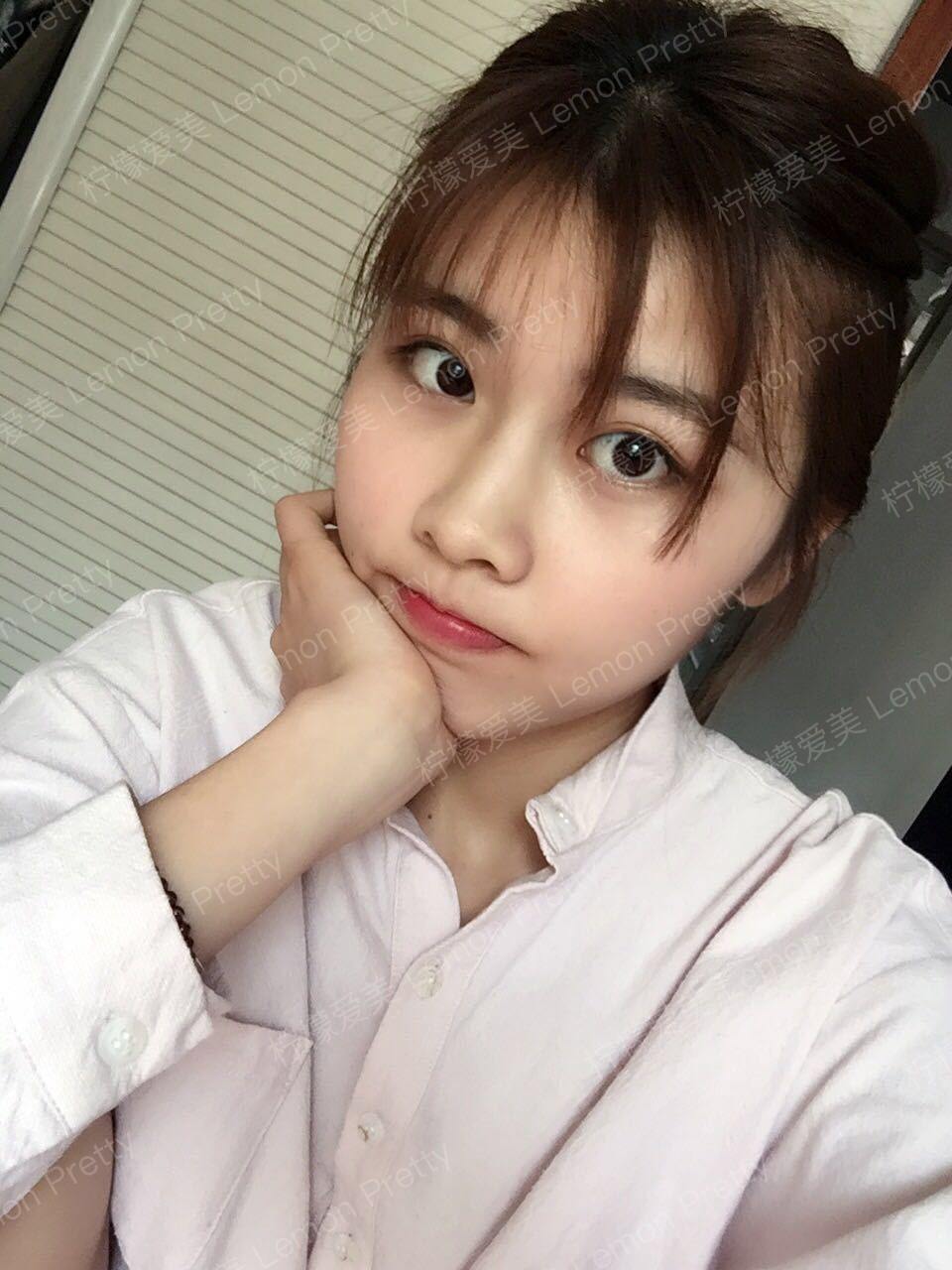 玻尿酸隆鼻的真实分享体验～对鼻子不满意又害怕动刀的小仙女可以试试