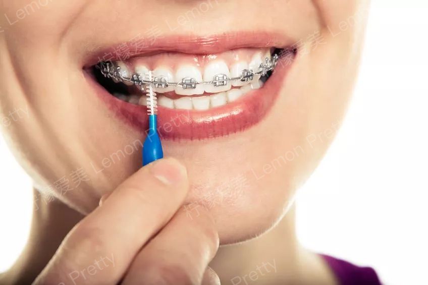 突出,地包天,小虎牙或牙齿不整齐等小问题,   都能通过牙齿矫正解决的