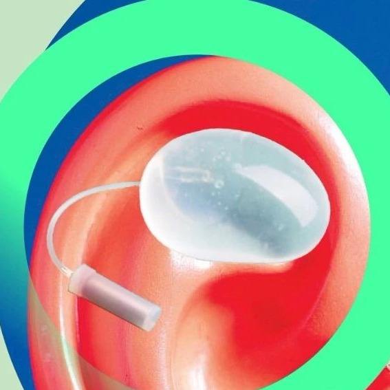 耳再造#扩张器最初发明时,注射阀门就是内置的,当时发明者是如何想的