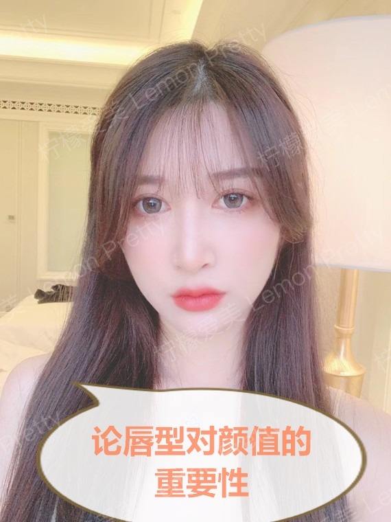 【嘴角上扬术】★口角上扬术★微微一笑性感迷人 ￥6800 北京画美医院