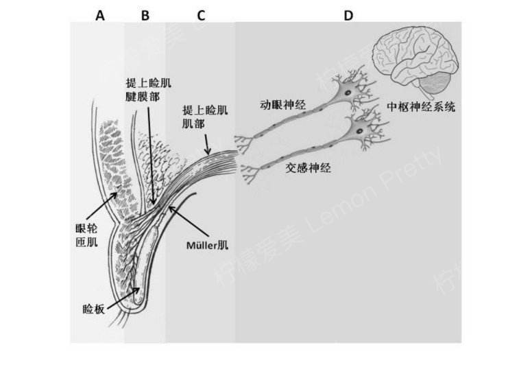 为什么做完上睑提肌后,眼睛闭不上了?