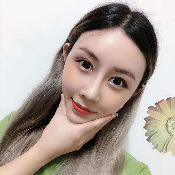 割双眼皮一个月,发现俩眼睛不一样,一个是